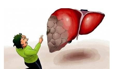 頭部出現這4種狀況,就要注意你的肝了!